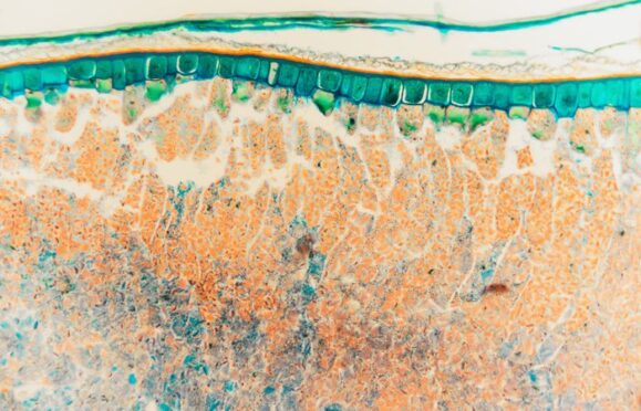 Microscopic view of a leaf. 